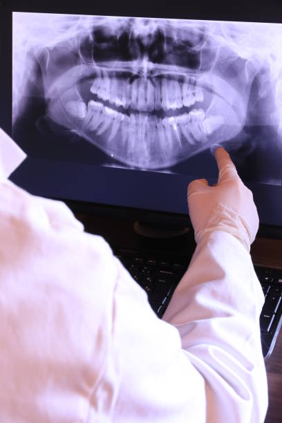 Best Emergency Tooth Extraction  in Fredonia, NY