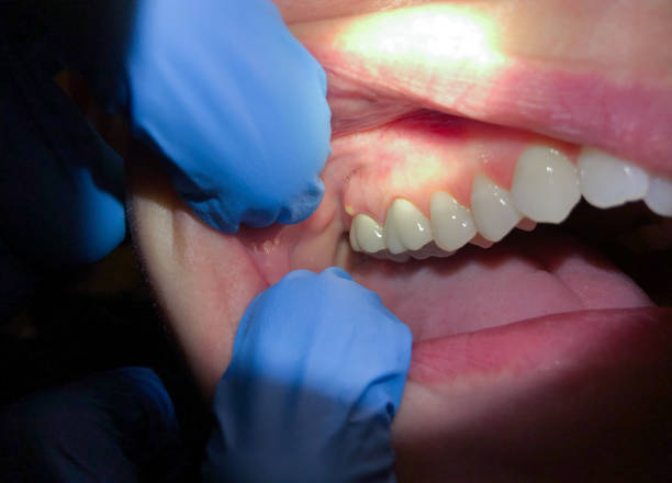 Best Dentist for Dental Trauma  in Fredonia, NY